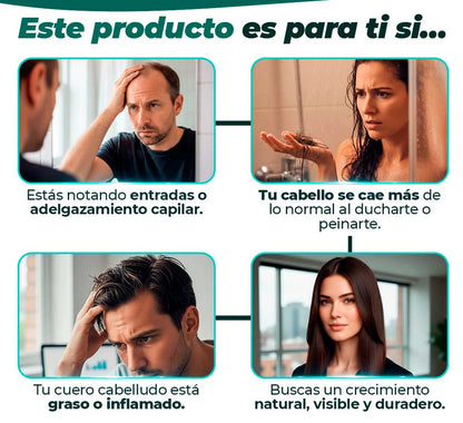DHT - Recupera tu cabello desde la Raíz