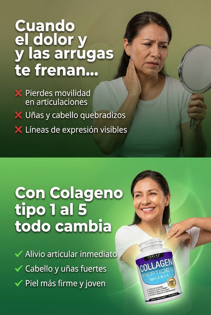 Colageno tipo 1 al 5 — 2. Problema → Solución